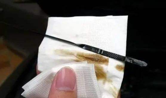 星瑞机油尺在哪里-有驾 星瑞机油尺在哪里-有驾